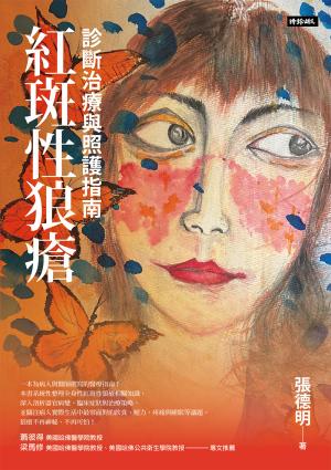 紅斑性狼瘡：診斷治療與照護指南